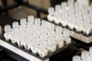 Beyond the Blueprint: Why Your Genes Don't Tell the Whole Story of Your Health