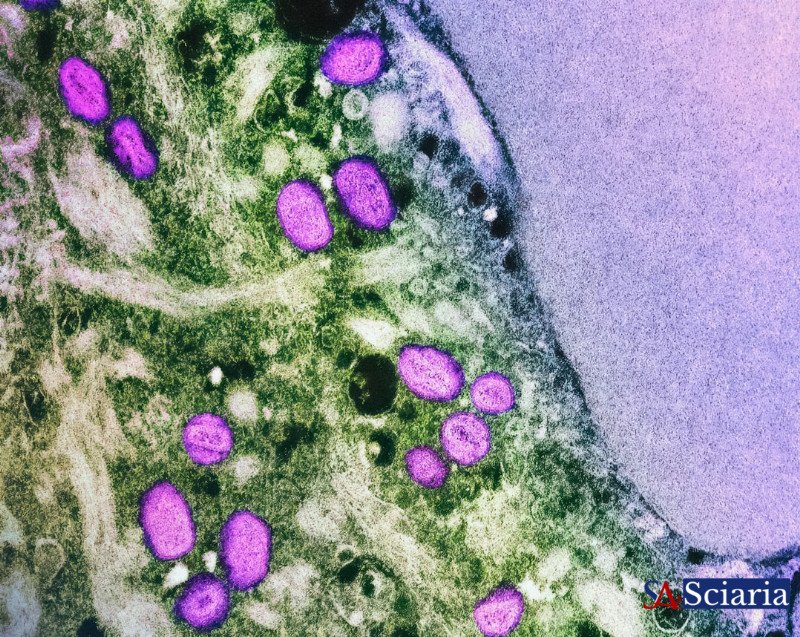 Gut Print Eating: Crafting Your Microbiome's Unique Menu for Optimal Health